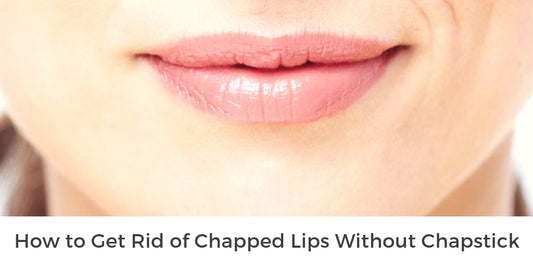 How to Get Rid of Chapped Lips Without Chapstick